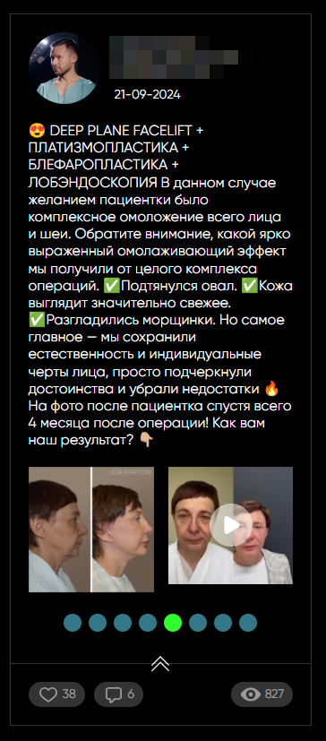 44labs: Посты из ВК 3